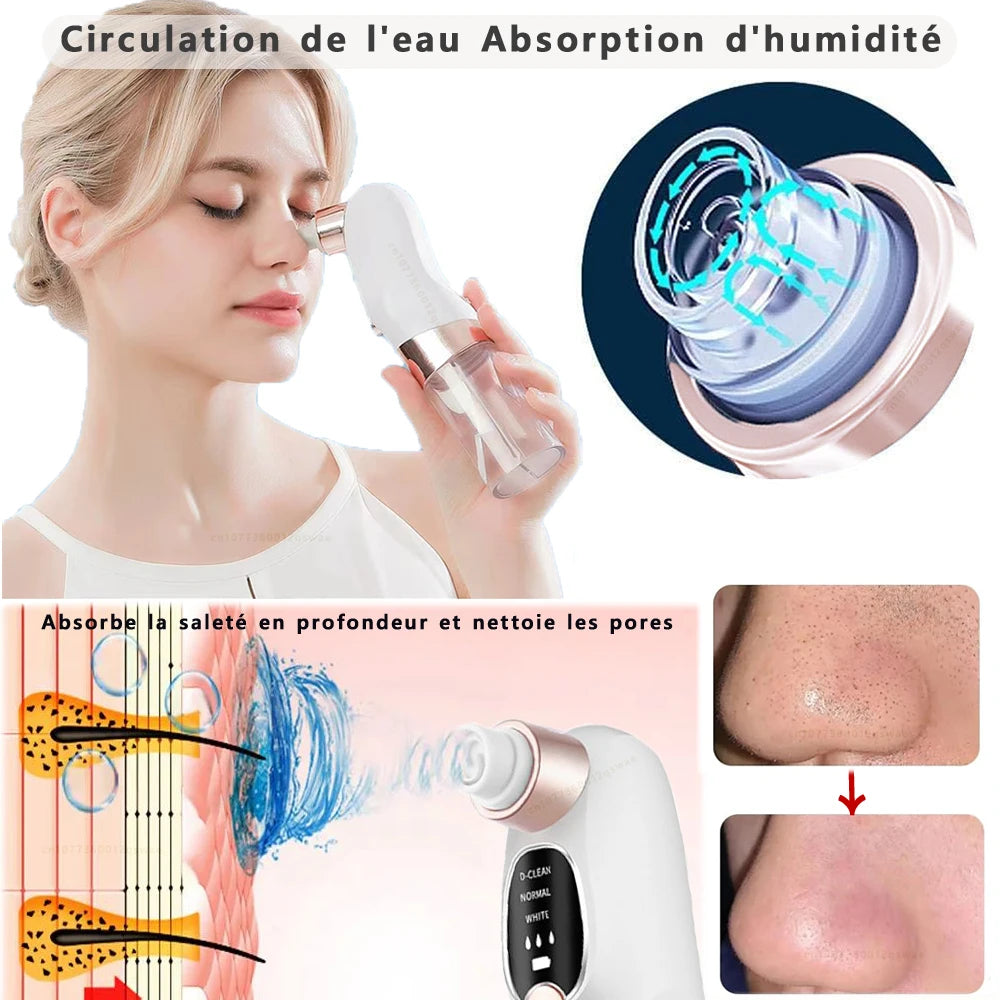 🧼 Aspirateur de Points Noirs à Microbulles