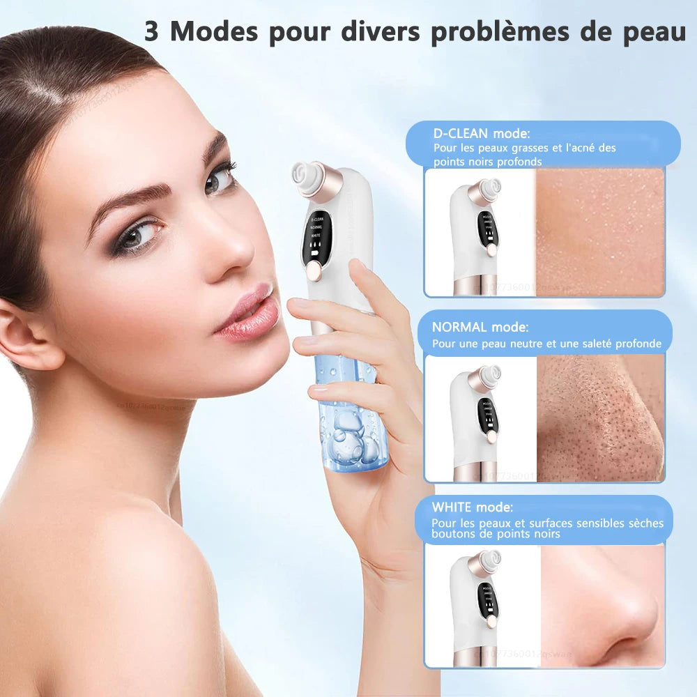 🧼 Aspirateur de Points Noirs à Microbulles