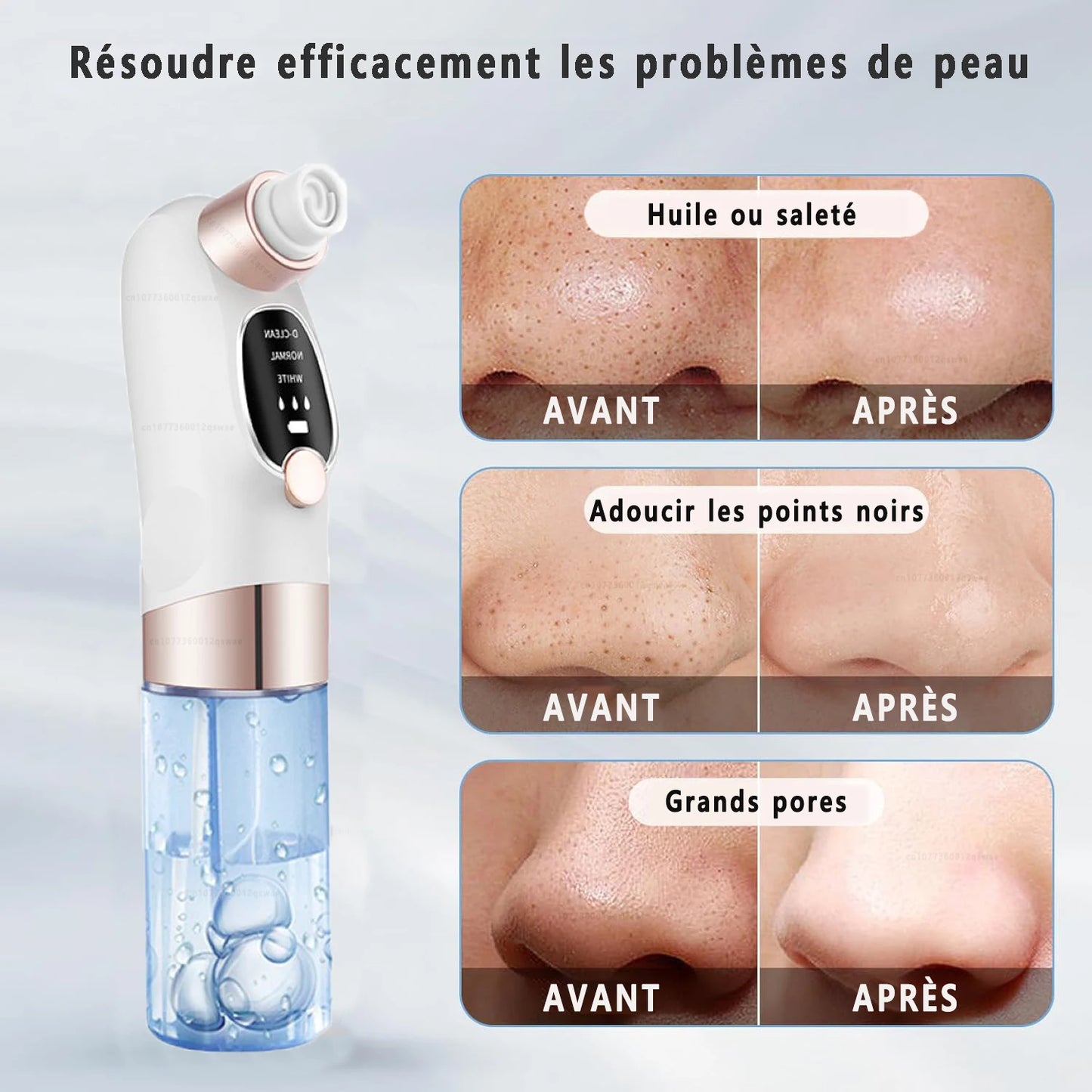 🧼 Aspirateur de Points Noirs à Microbulles